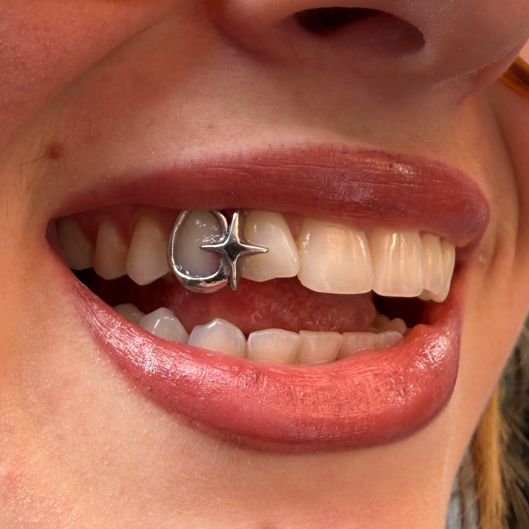 GRILLZ OPEN FACE + LOSANGE FIN