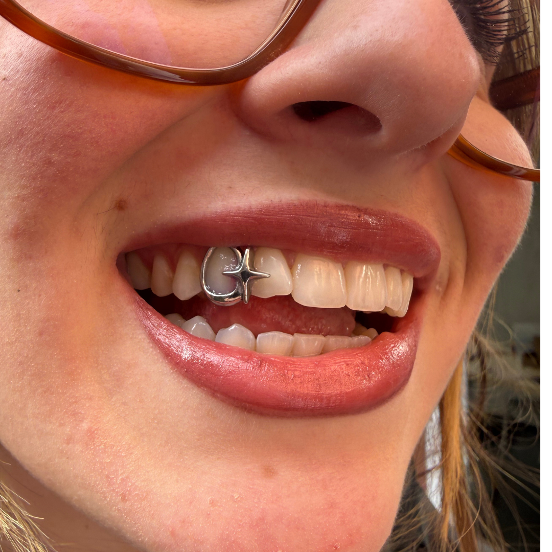GRILLZ OPEN FACE + LOSANGE FIN