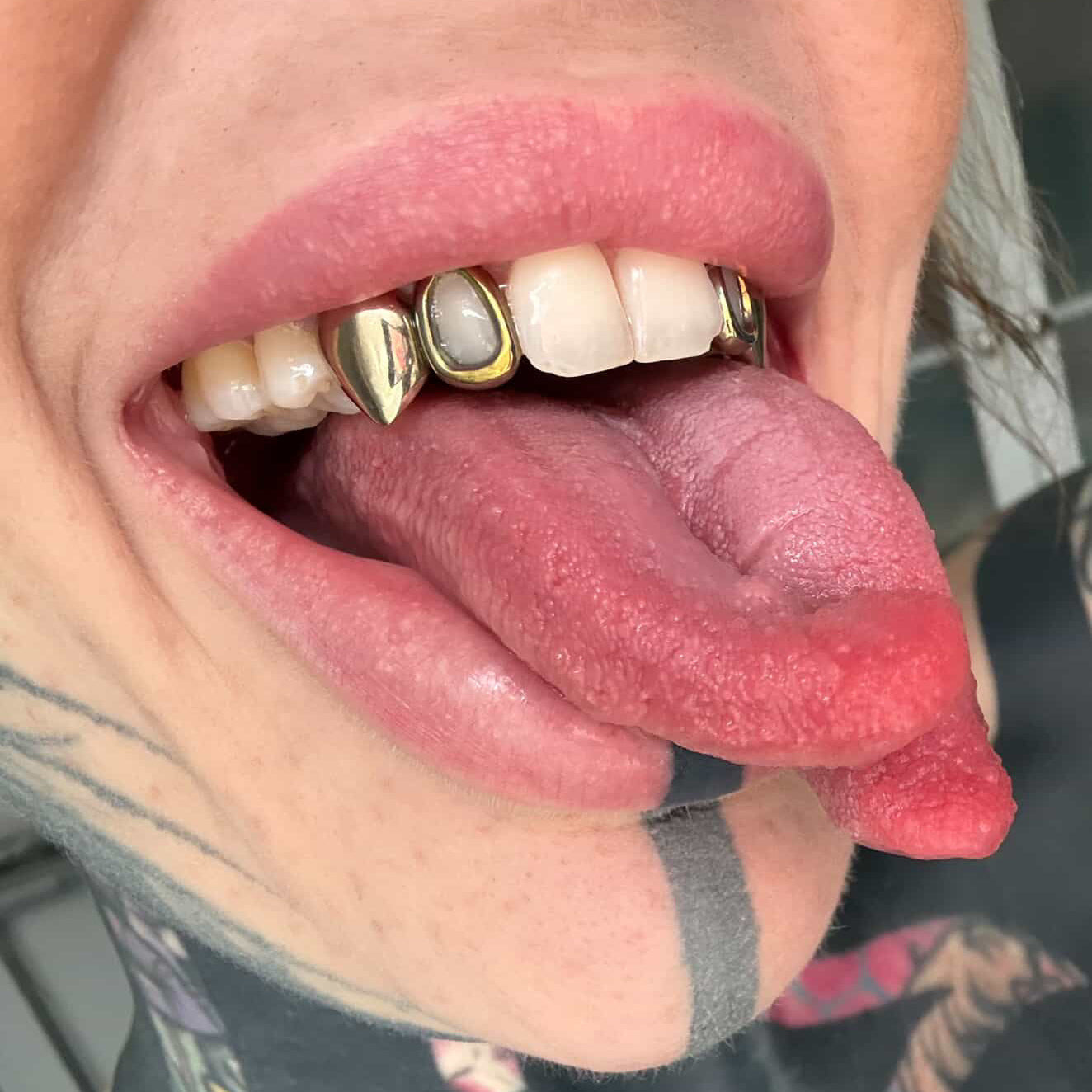 GRILLZ OPEN FACE TITANE GOLD EFFECT