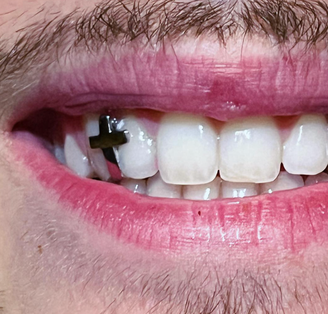 GRILLZ CUSTOM SHAPE