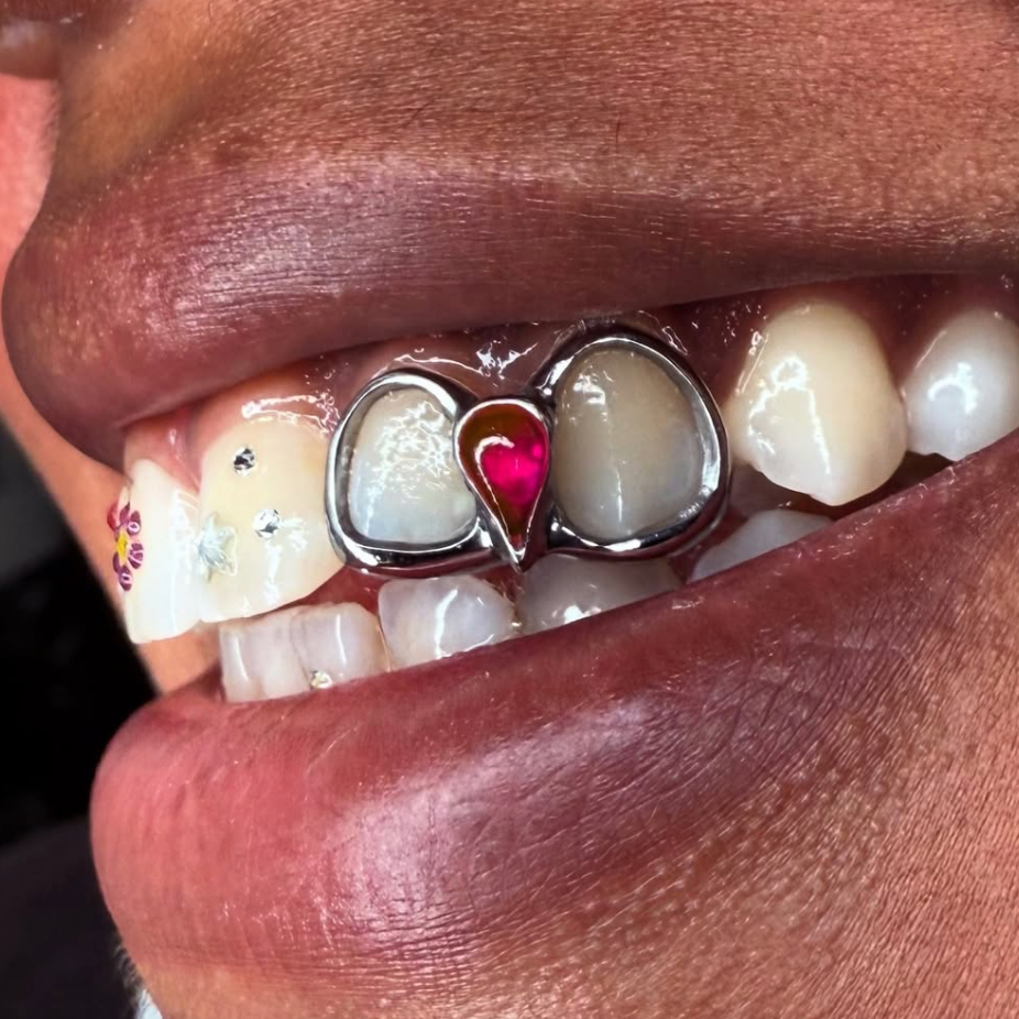GRILLZ PINK INTERSTICE + 2 GRILLZS OPEN FACE