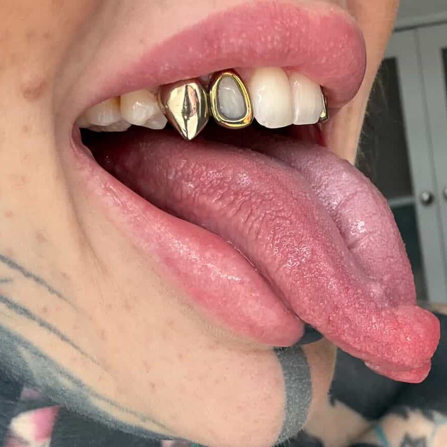 GRILLZ OPEN FACE TITANE GOLD EFFECT