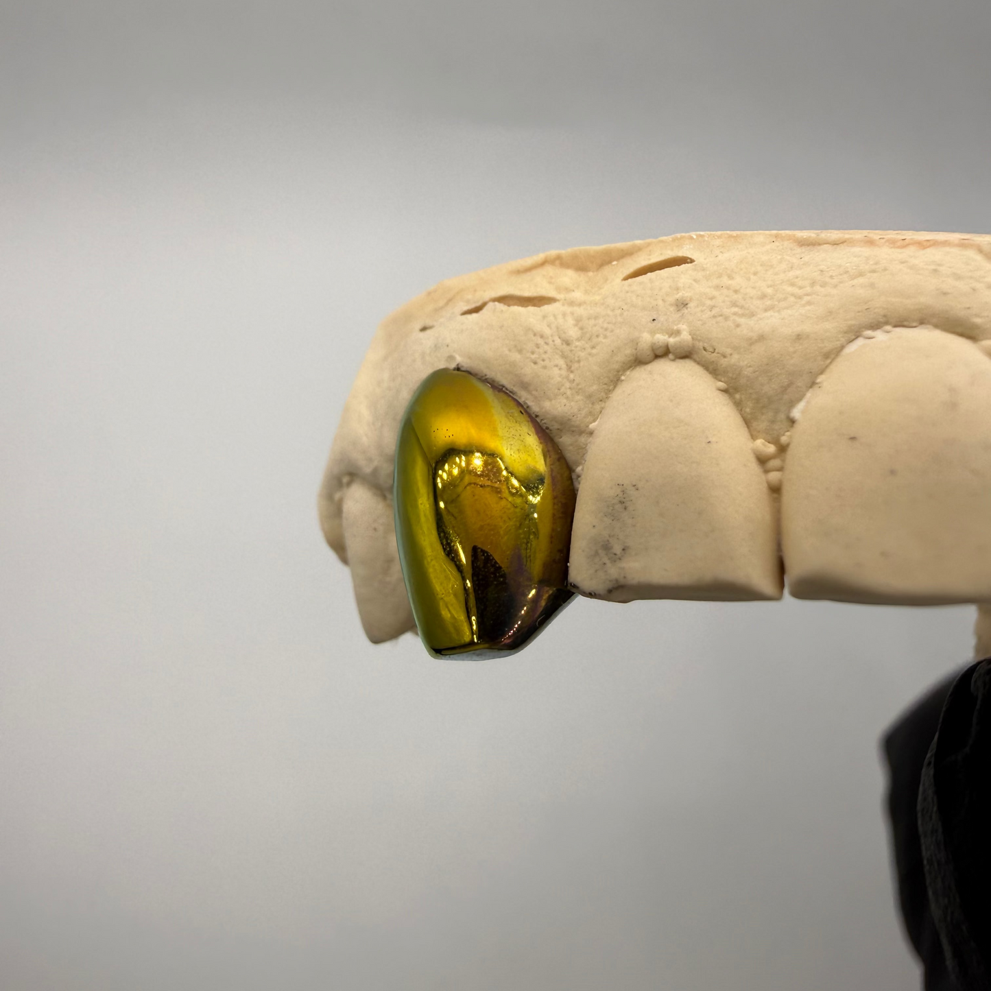 GRILLZ TITANE GOLD EFFECT