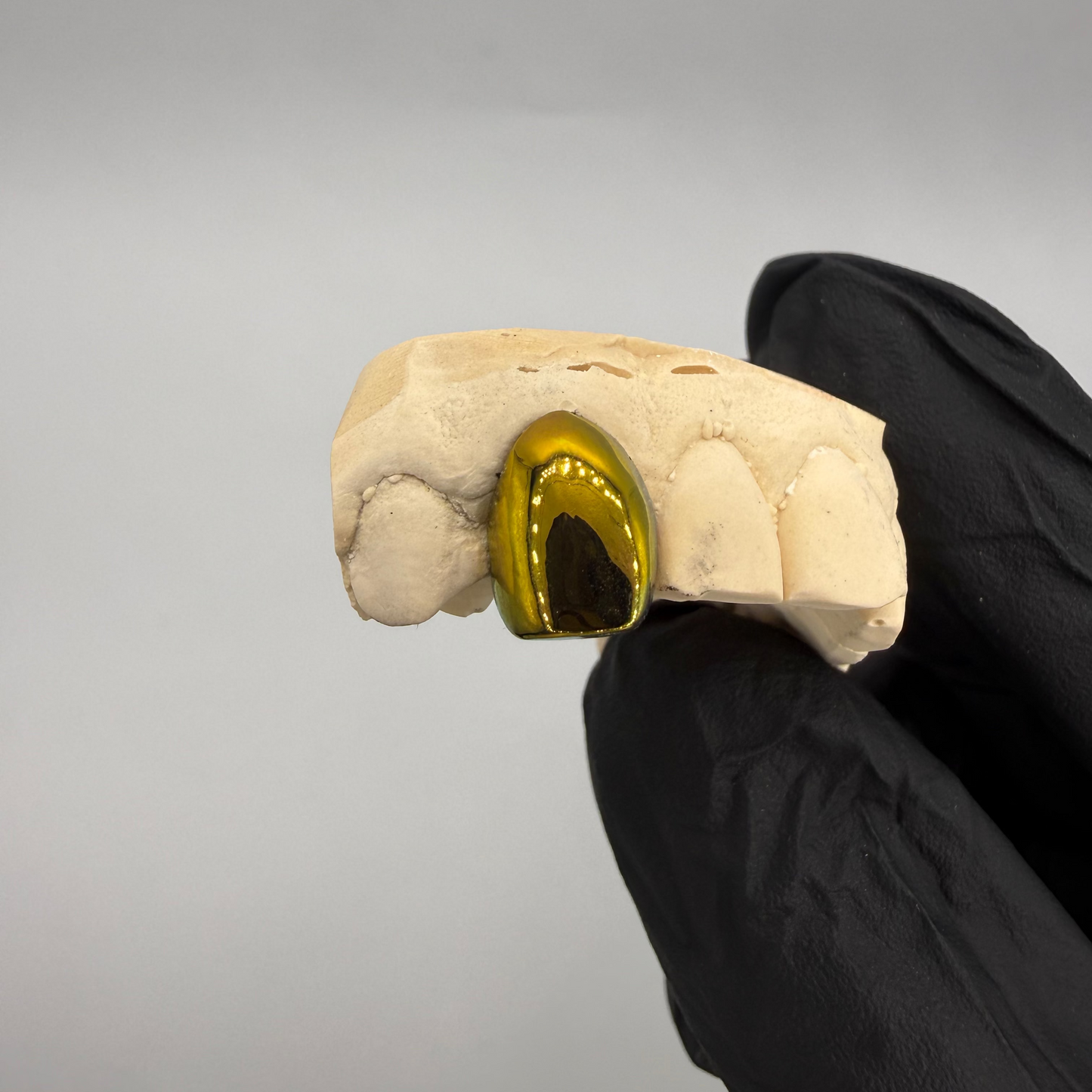 GRILLZ TITANE GOLD EFFECT