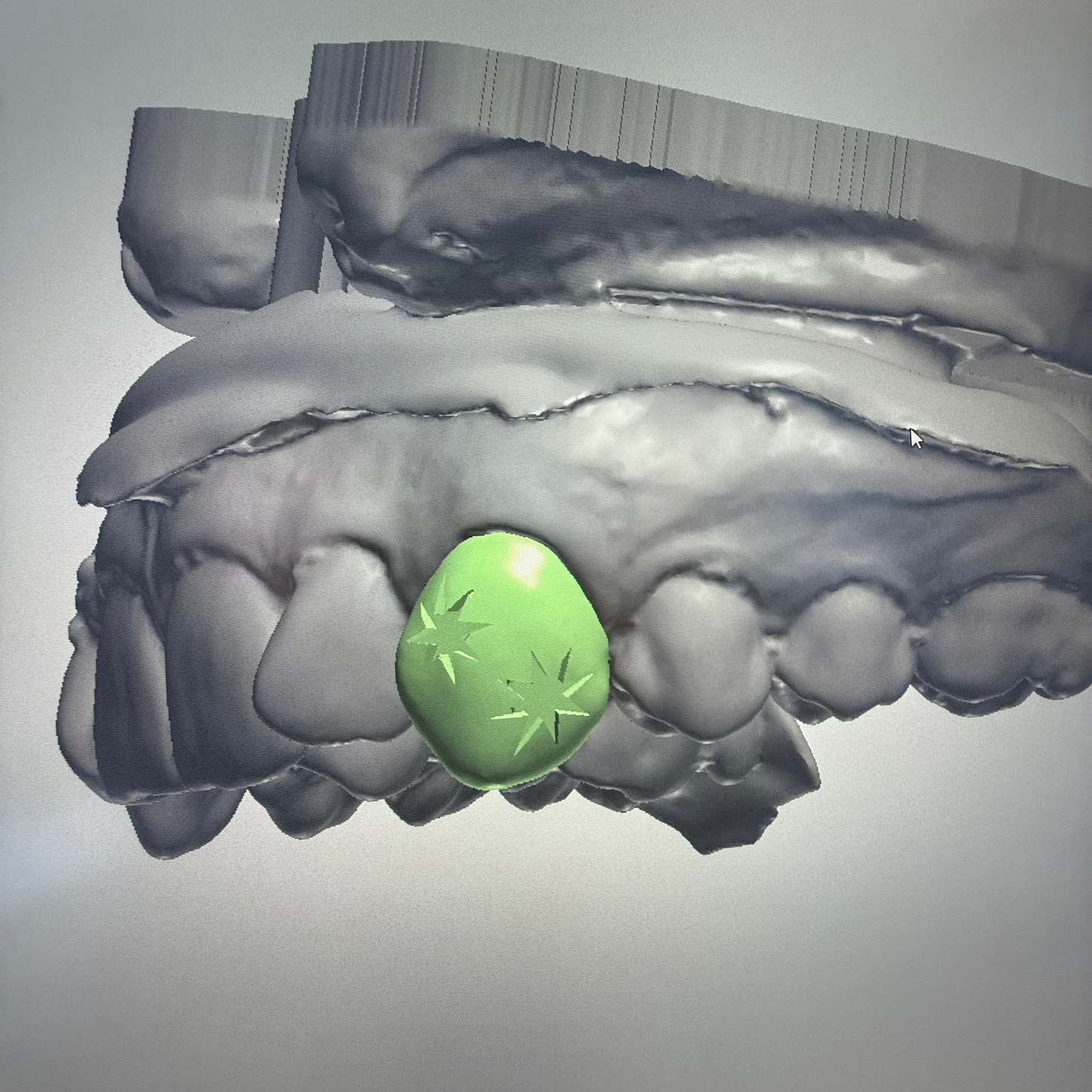 GRILLZ IMPACT DE BALLES