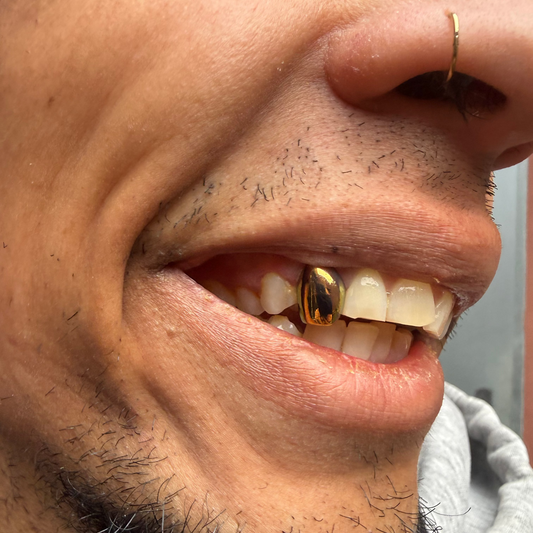 GRILLZ TITANE GOLD EFFECT