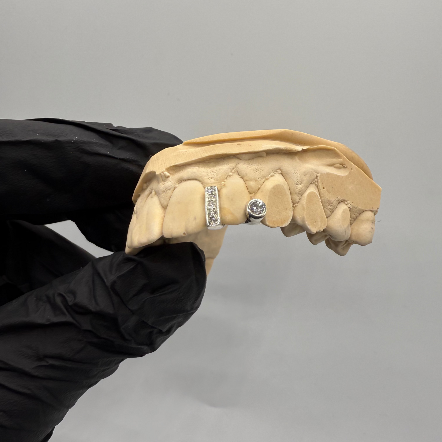 GRILLZ INTERSTICE SERTI + GRILLZ CLOS SERTI