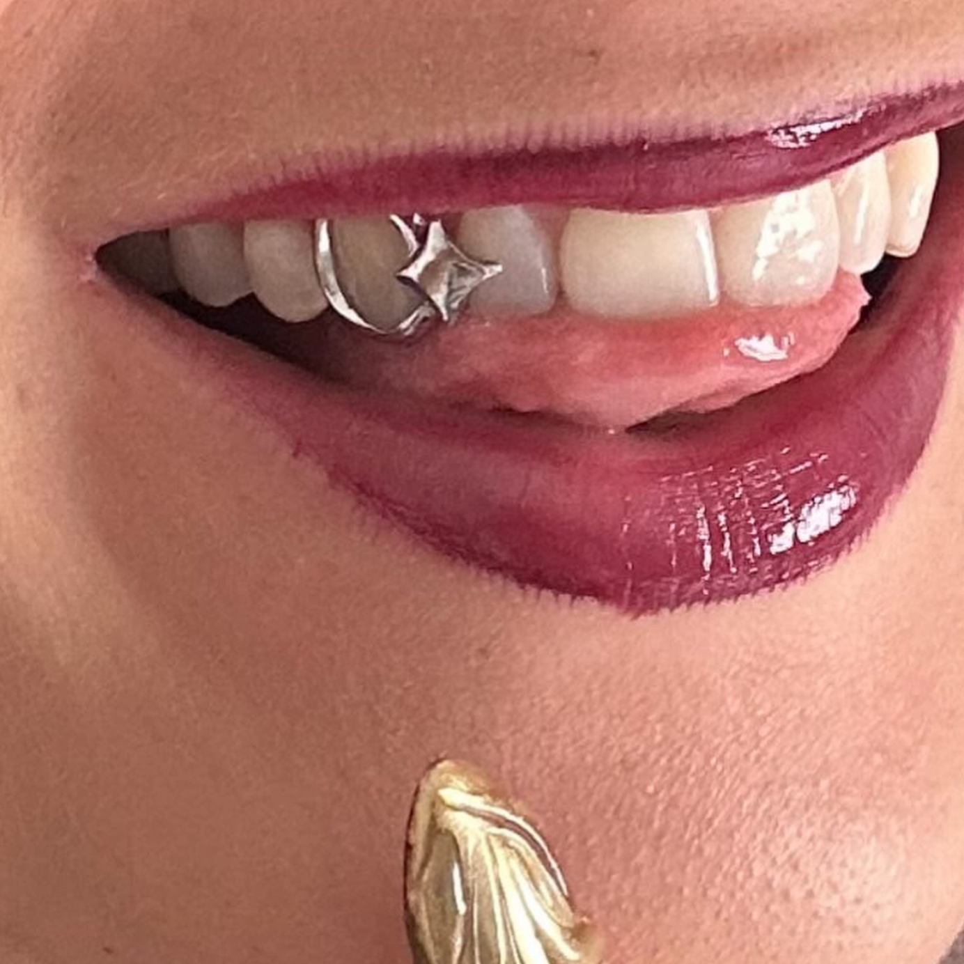 GRILLZ OPEN FACE + PETIT LOSANGE